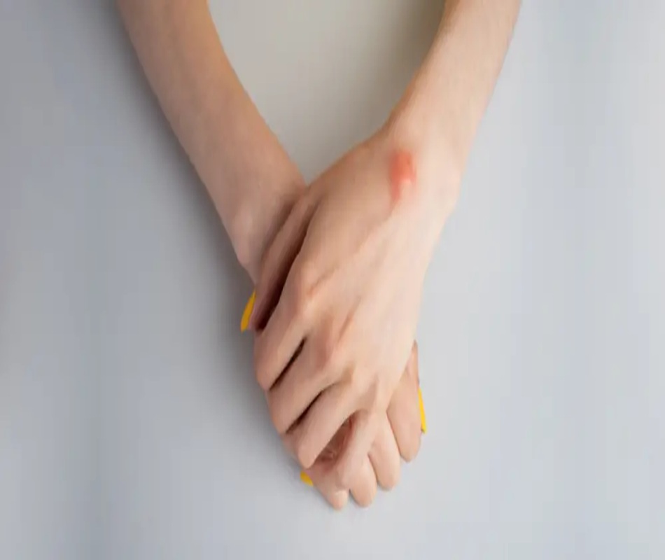 Lipoma Treatment Altrincham, Bollin Clinic Lipoma Removal, benign lump treatment UK, soft tissue surgery Altrincham, lipoma excision recovery UK