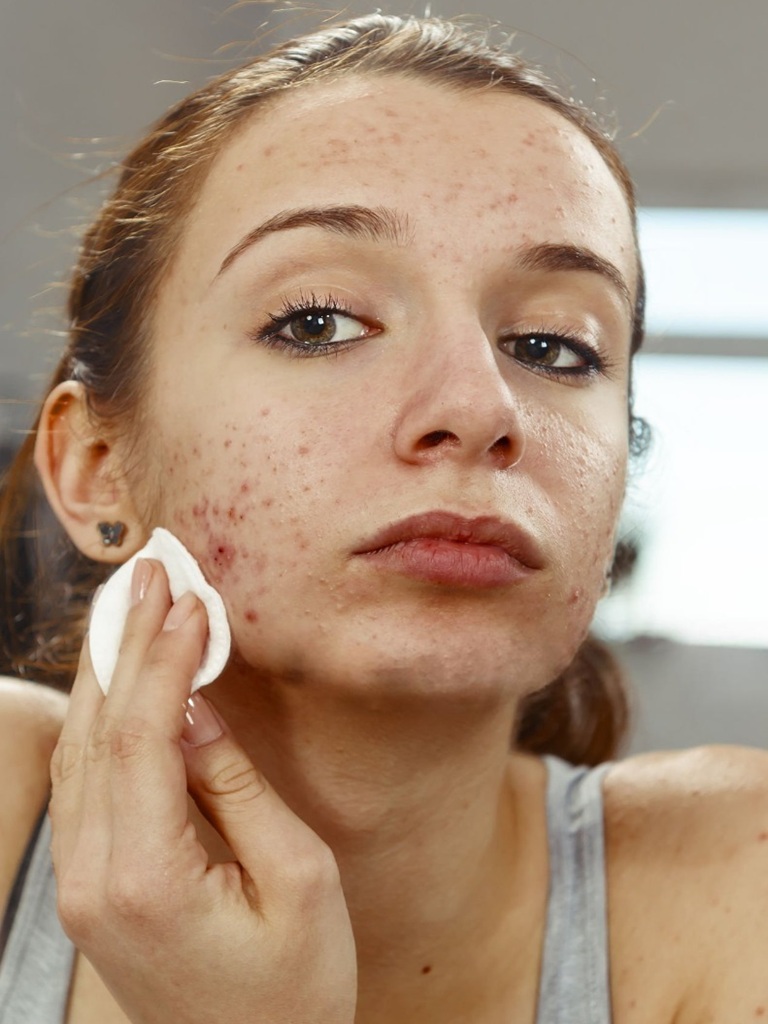 Expert Skin Lesions Treatment in Altrincham, UK
