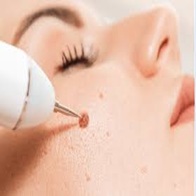 body treatment
