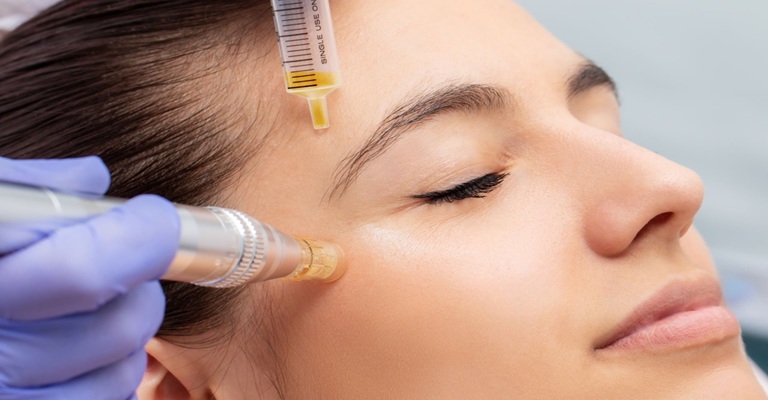 SkinPen Microneedling Treatment in Altrincham, UK