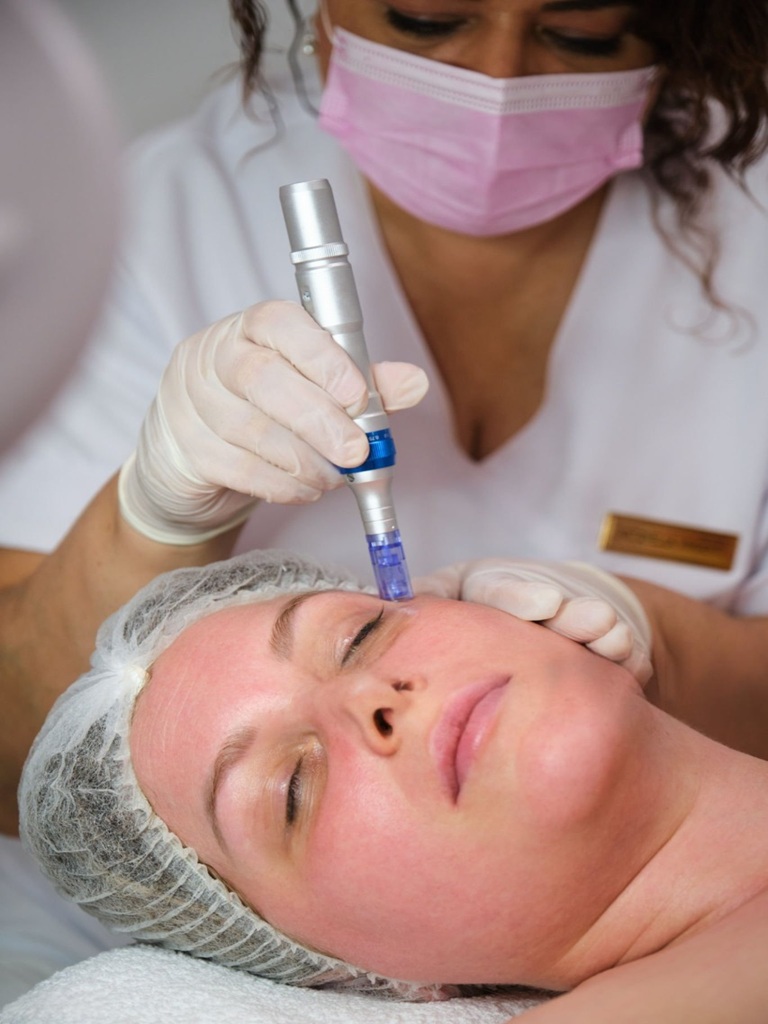 SkinPen Microneedling Treatment in Altrincham, UK