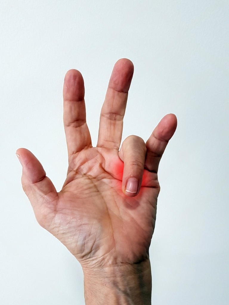 Trigger Finger Surgery Altrincham - Bollin Clinic
