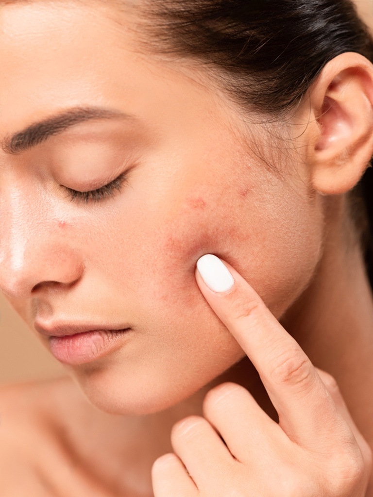 Scar Removal Treatment at Bollin Clinic