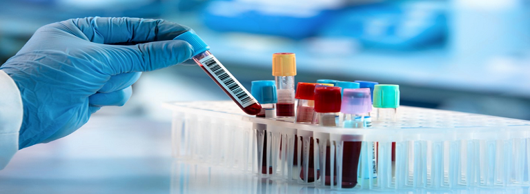 Best Blood Test Centre in Altrincham