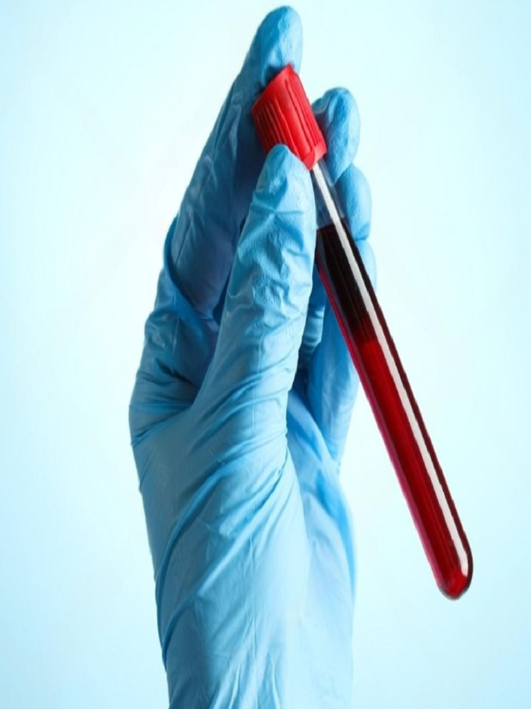 Best Blood Test Centre in Altrincham