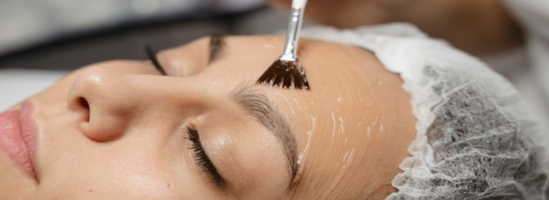 Chemical Peel Treatment at Bollin Clinic