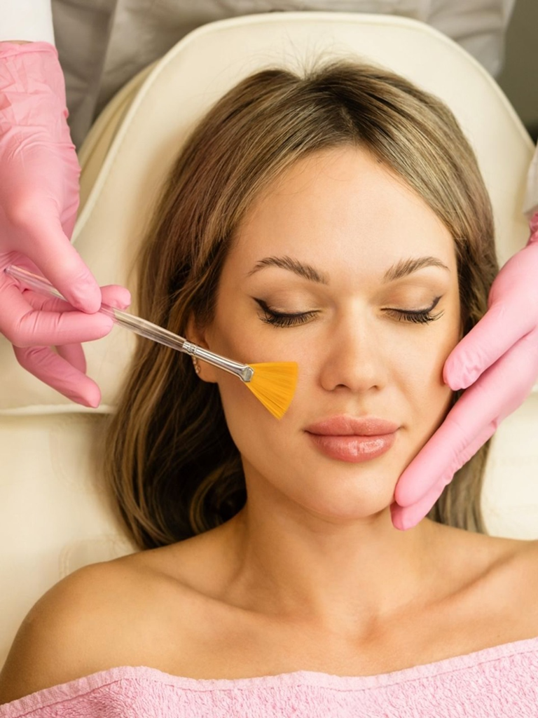 Chemical Peel Results