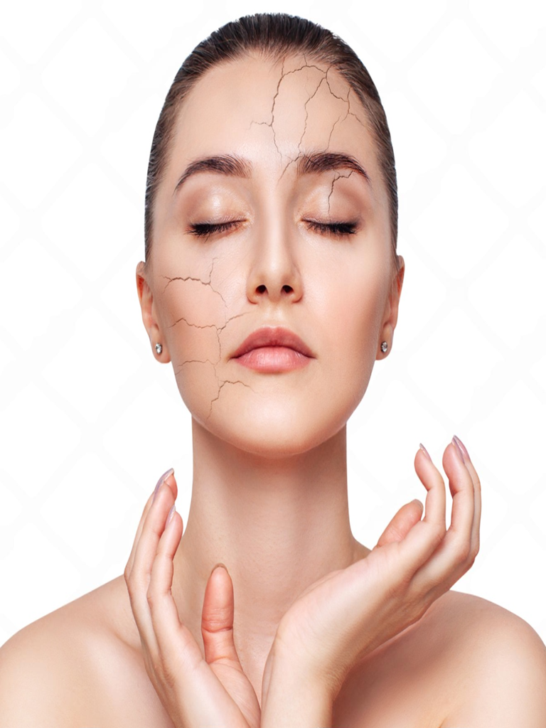 Dry, Dehydrated Skin treatment at Bollin Clinic