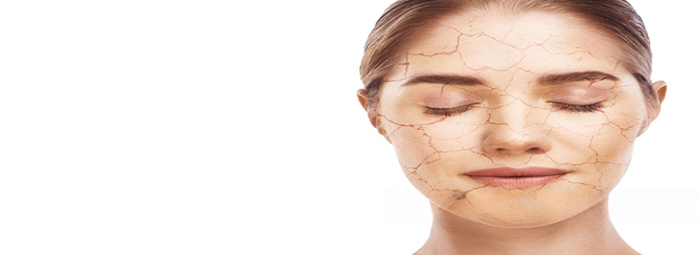 Dry, Dehydrated Skin treatment At Bollin Clinic