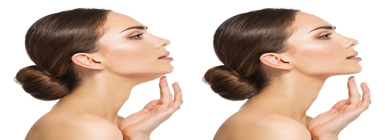 facial volume loss treatment At Bollin Clinic
