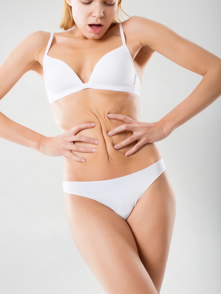 Best Mini Tummy Tuck Surgery in Altrincham, UK