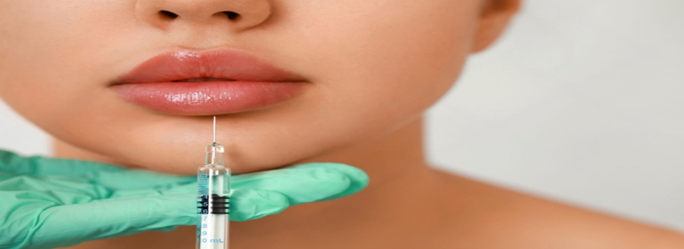 lips filler At Bollin Clinic