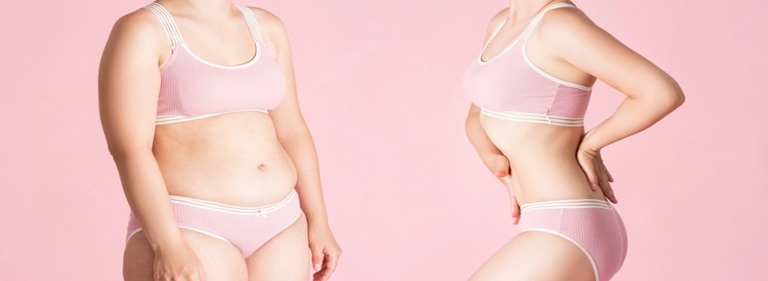 Best Mini Tummy Tuck Surgery in Altrincham, UK